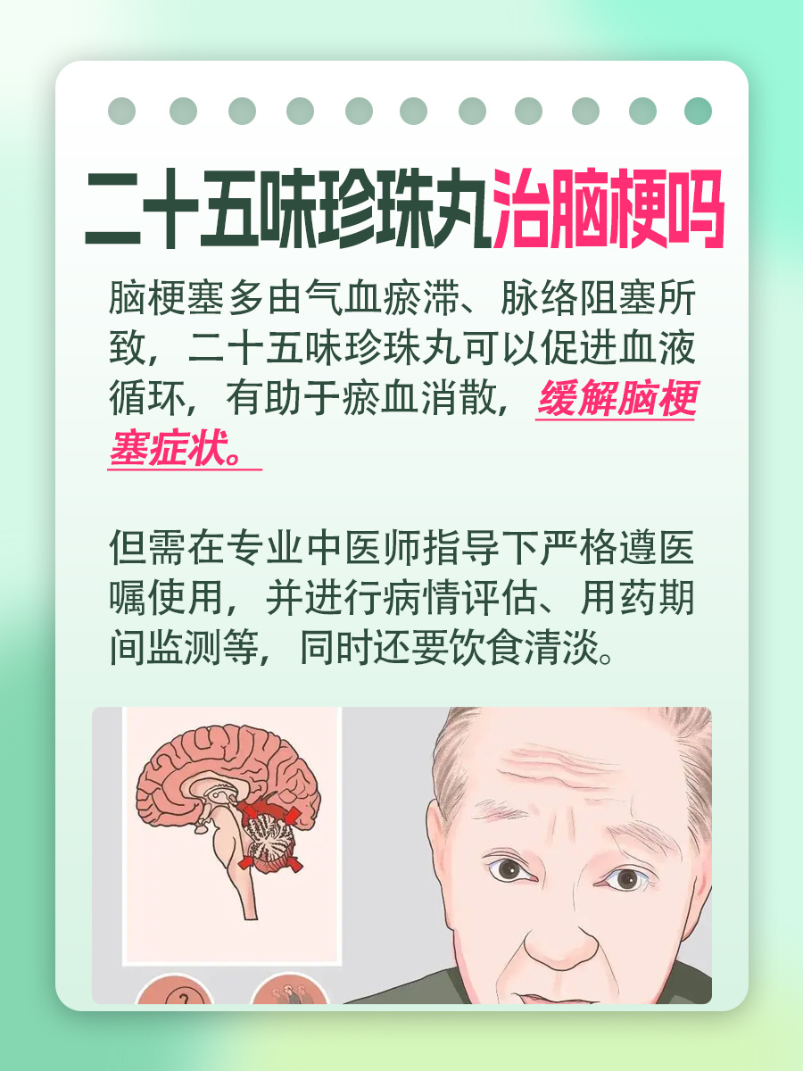 二十五味珍珠丸：可以治疗脑梗吗？