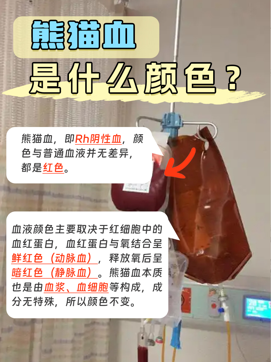 别再乱猜！熊猫血到底啥颜色，医生来告诉你
