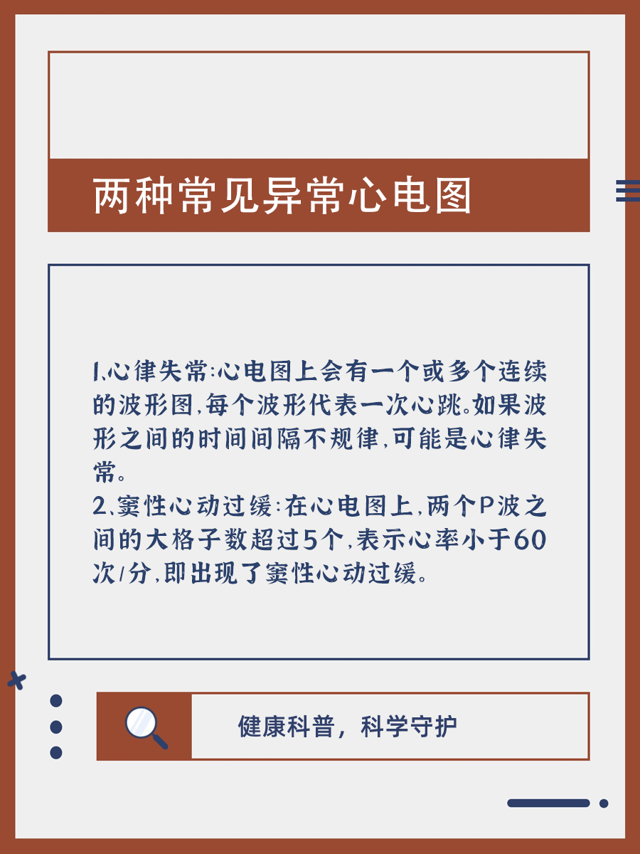 医生小课堂|心电图怎么看?