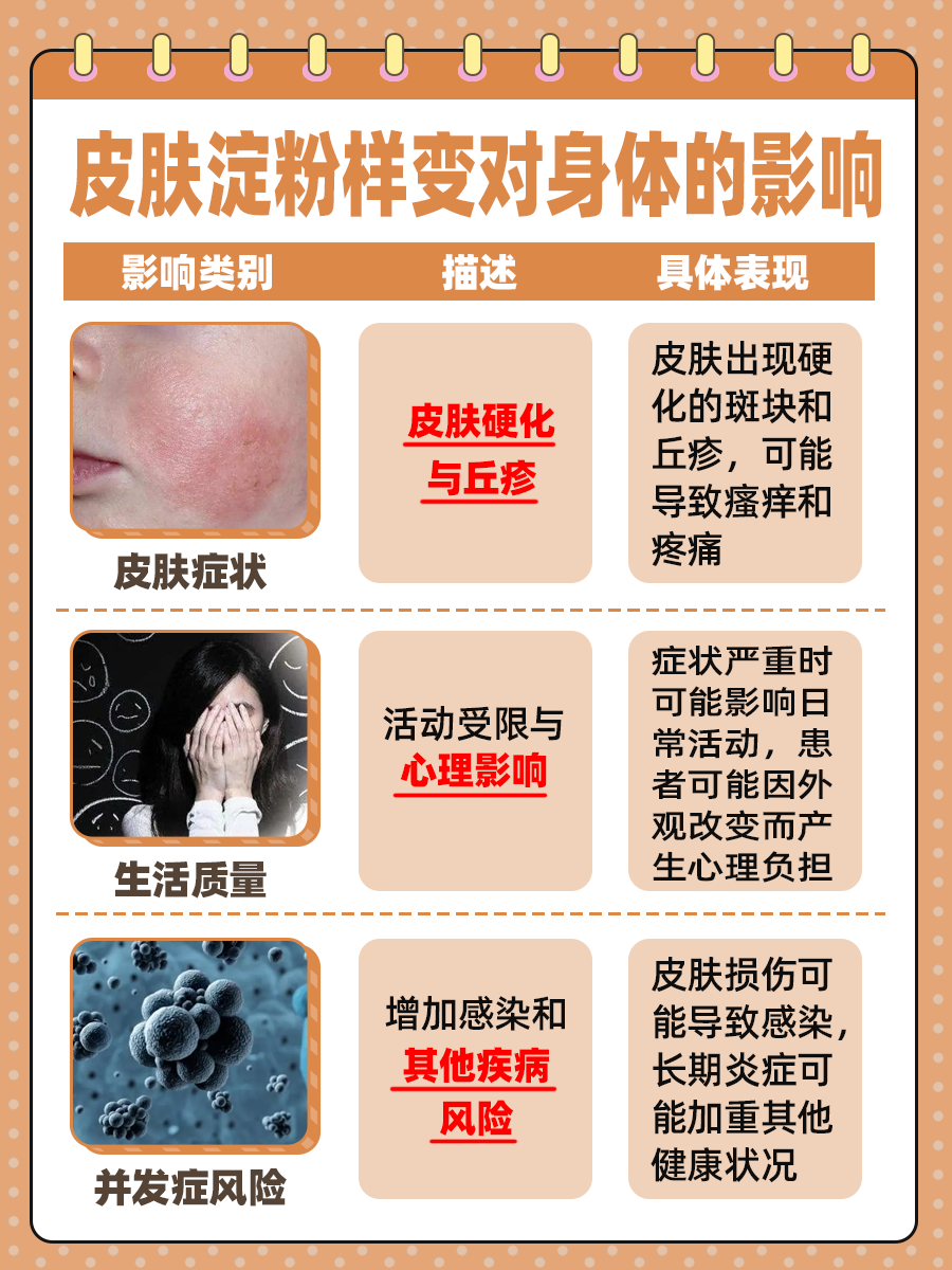 皮肤淀粉样变用药指南：哪种药物有效