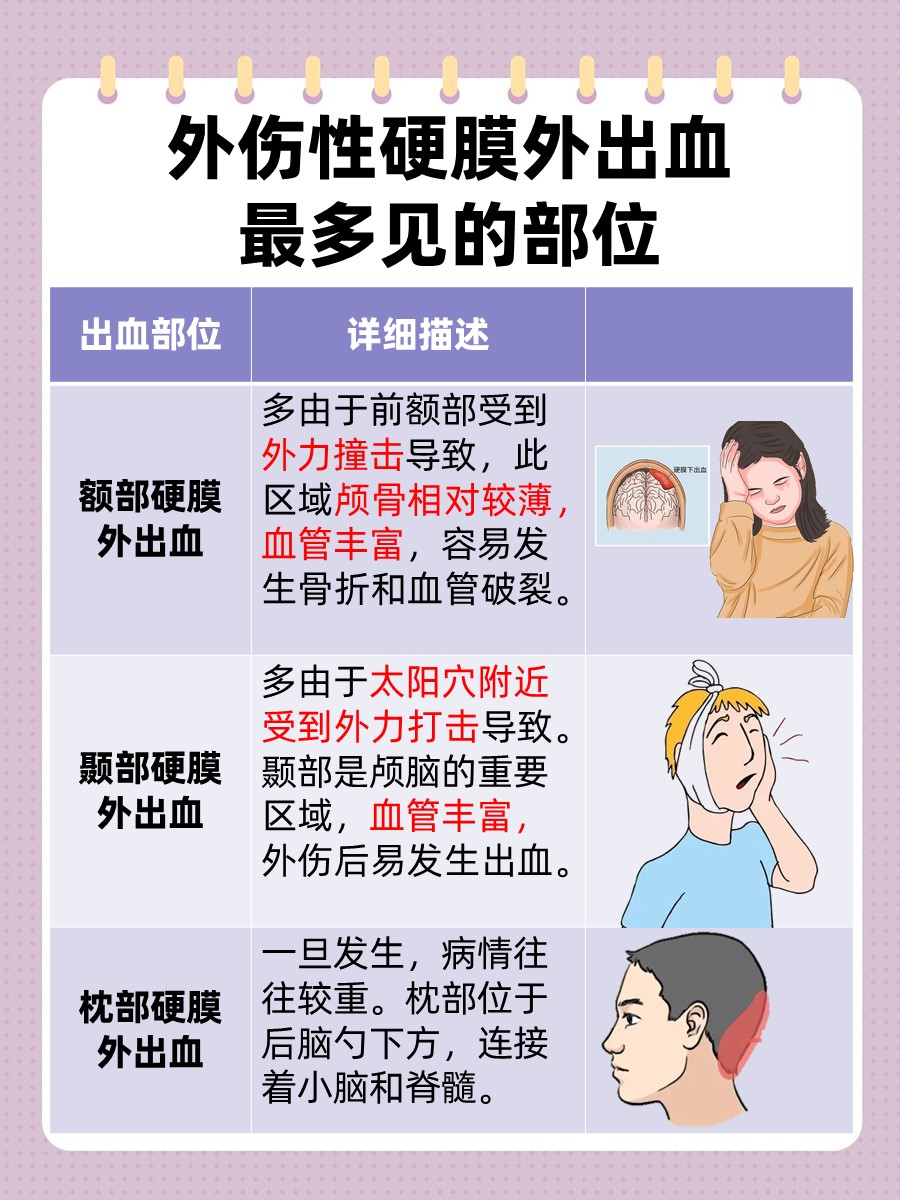 速度戳！外伤性硬膜外出血最多见于哪几个部位？