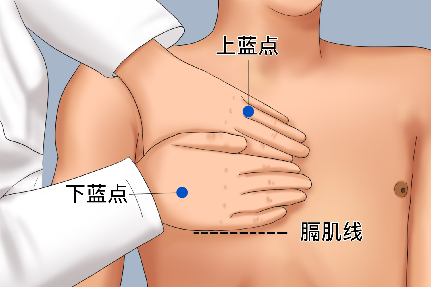 上下蓝点示意图