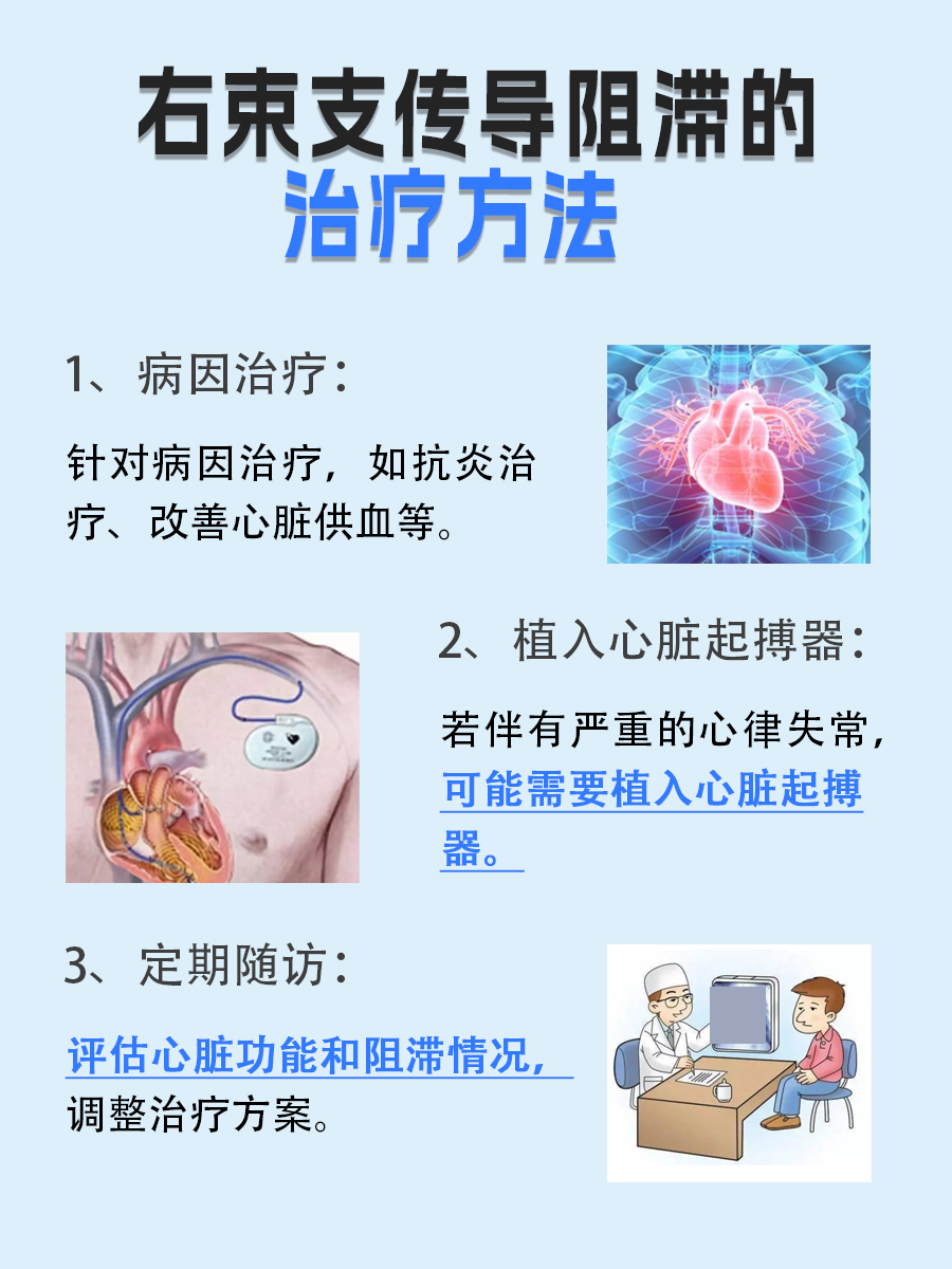 心电图右束支传导阻滞是怎么回事？一文了解