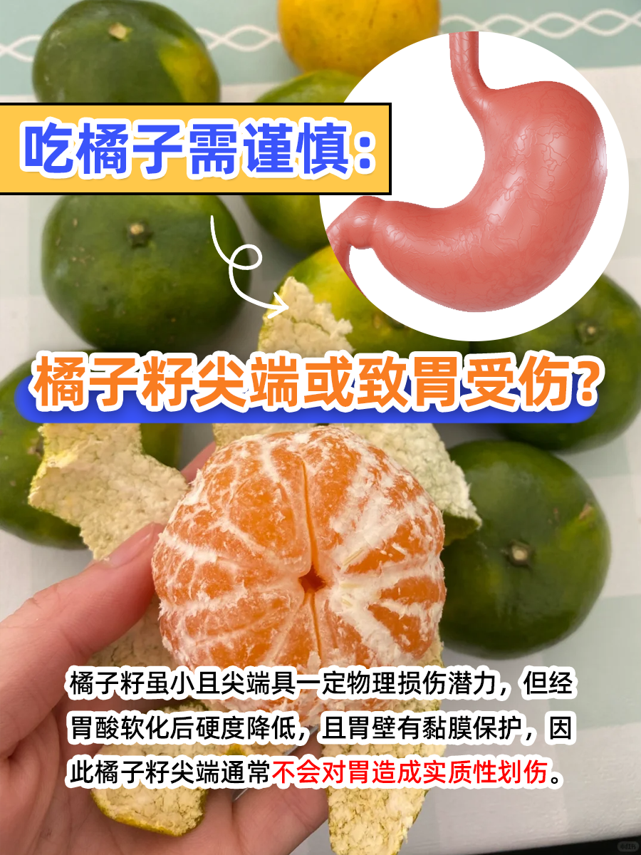 吃橘子需谨慎：橘子籽尖端或致胃受伤？