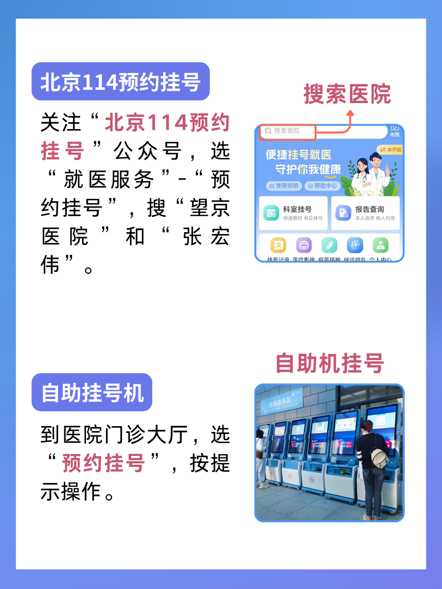 北京望京医院张宏伟医生怎么样?怎么挂号?