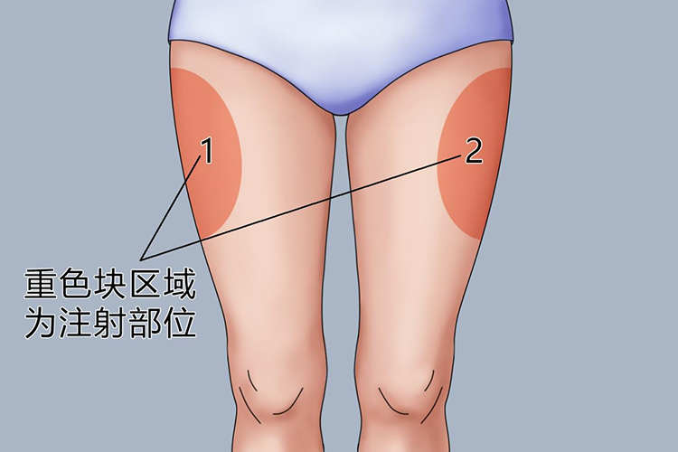 胰岛素打大腿的位置图图片