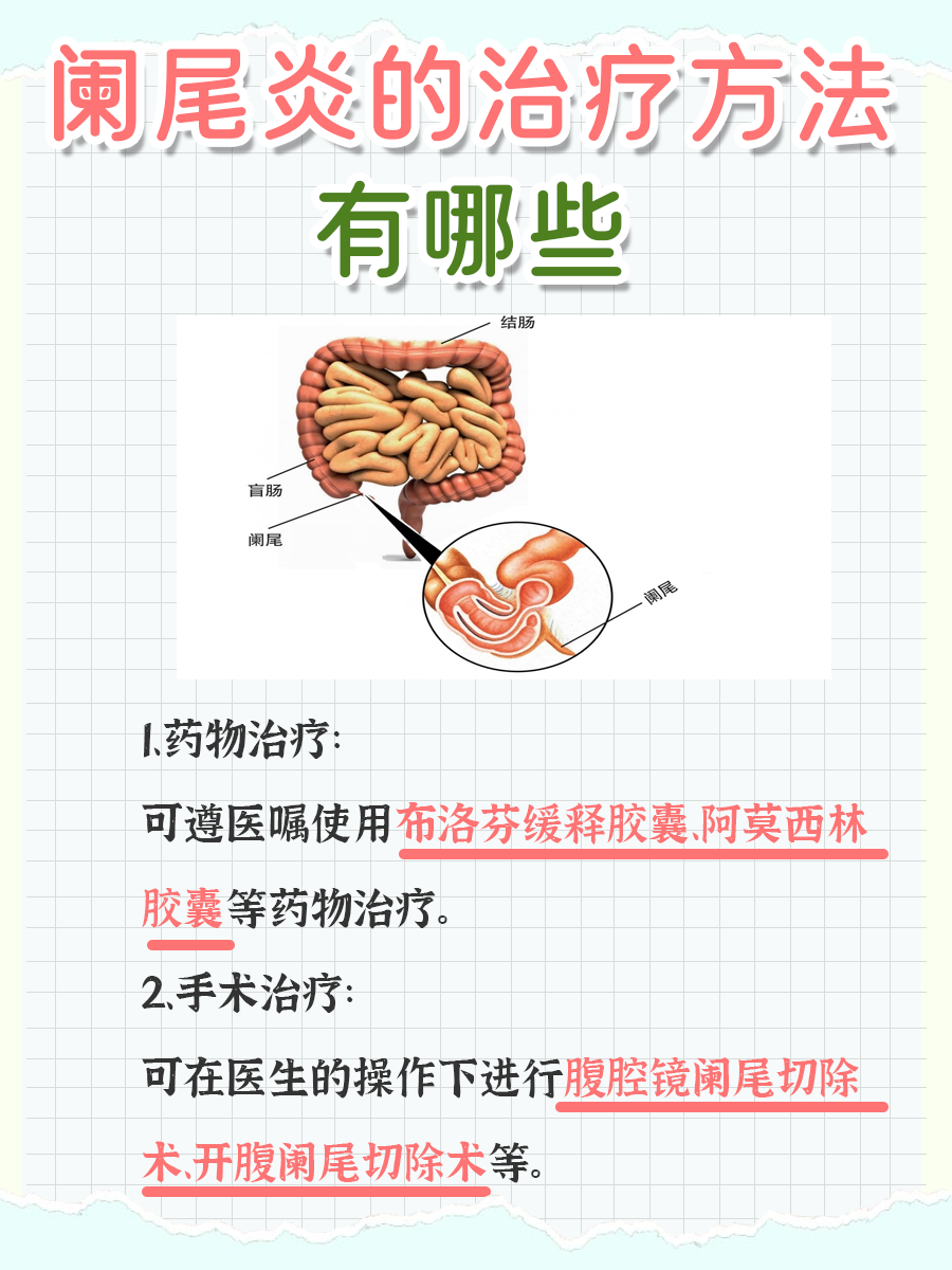 一文解析，阑尾炎吃什么药见效快