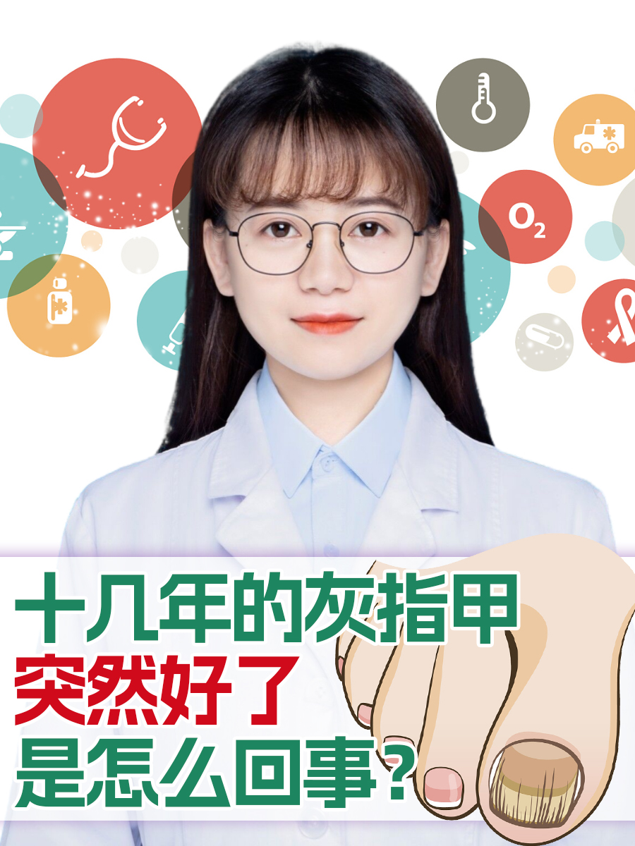 十几年的灰指甲突然好了，是怎么回事？