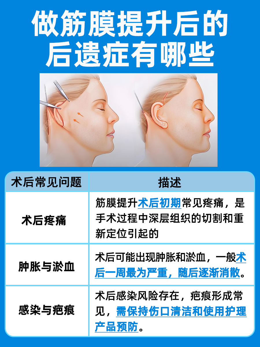 筋膜提升术后需警惕:全面解析常见后遗症