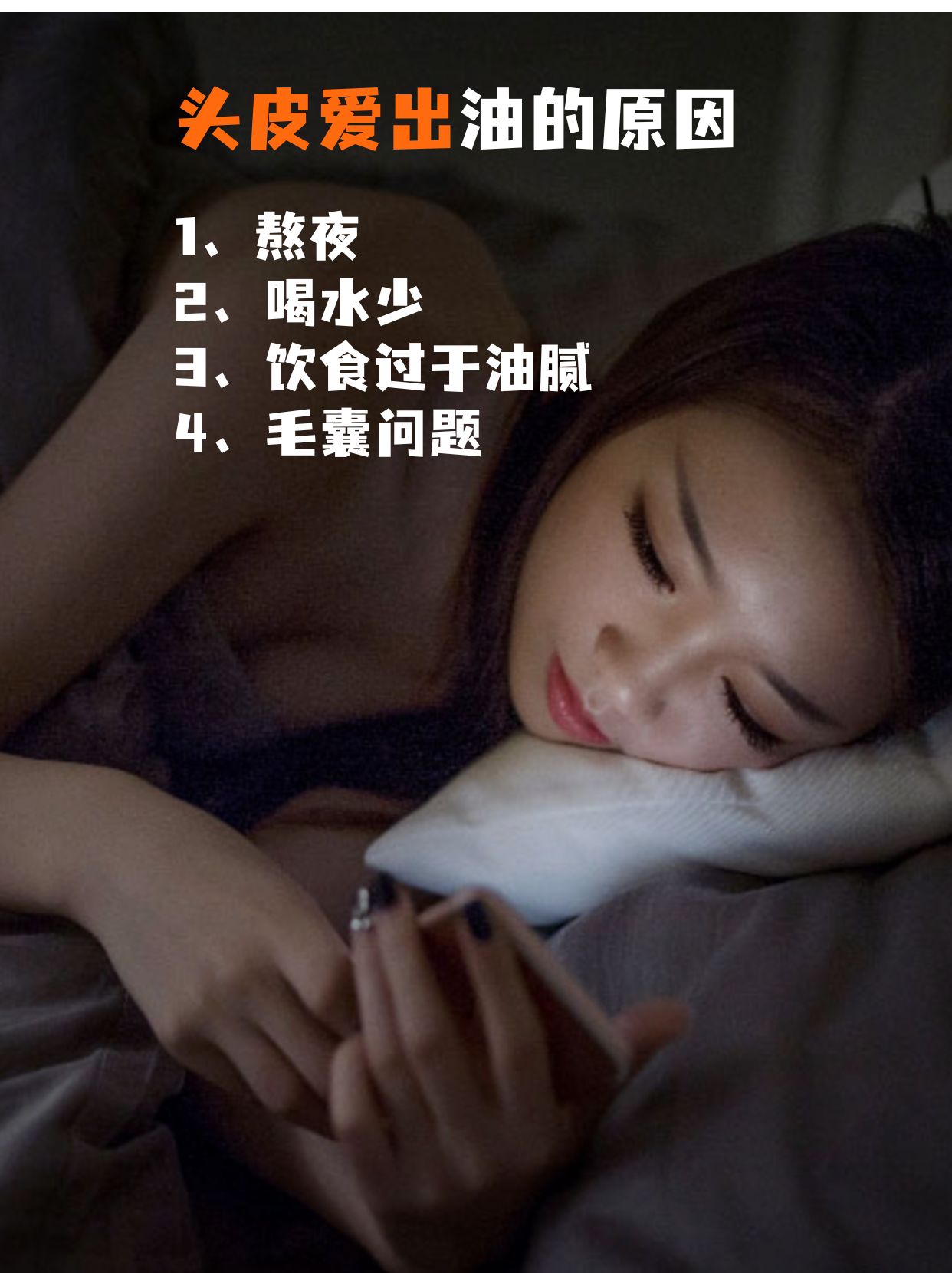 头油就用二硫化硒洗发水？这些知识你得了解