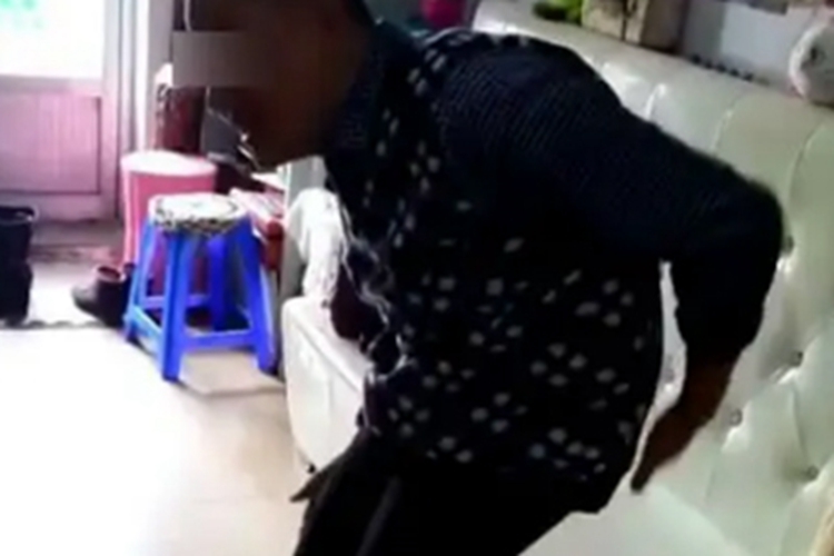 强直性脊柱炎后背突出图