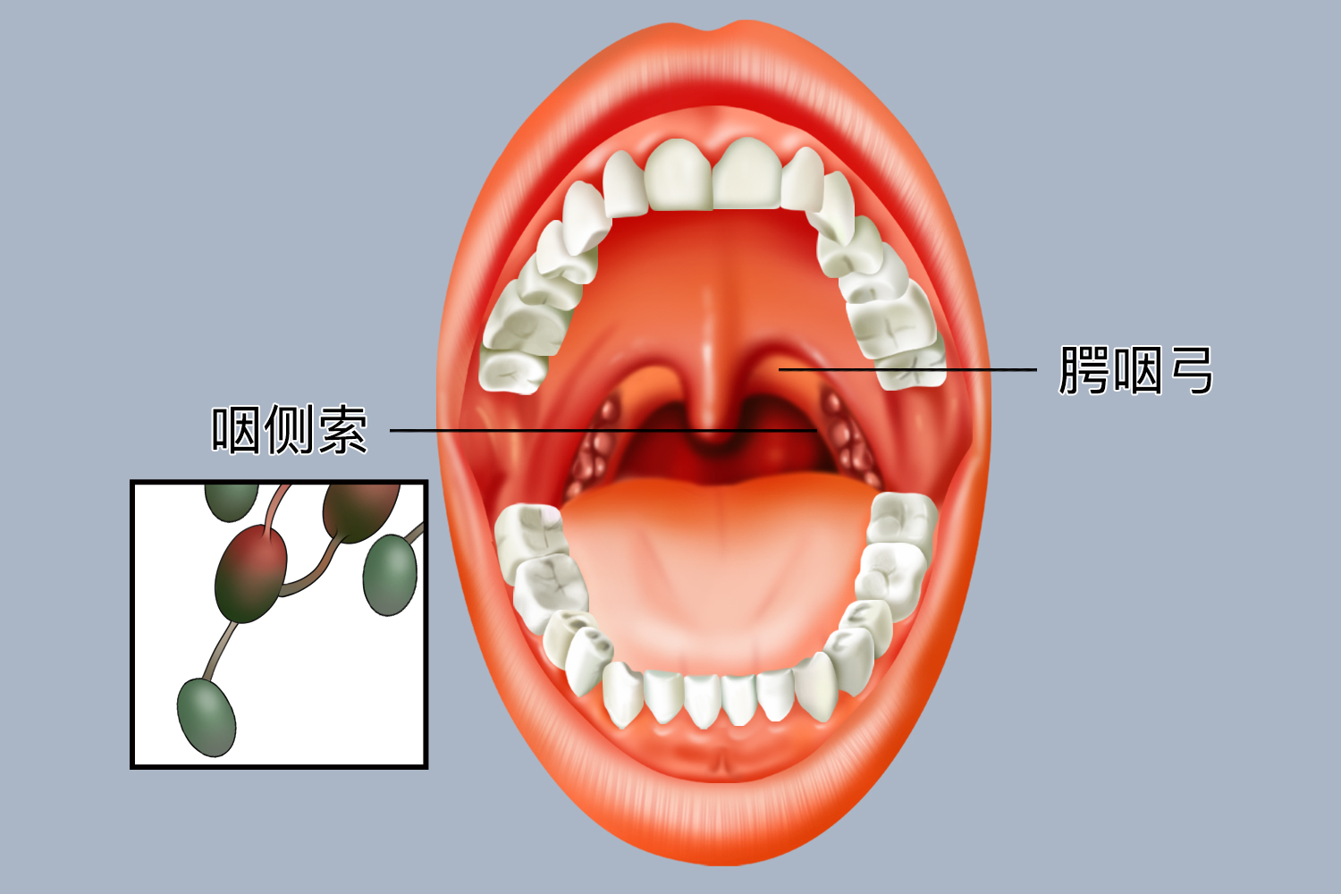 正常的咽侧索图