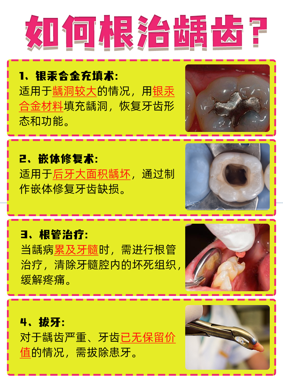 蛀牙痛几天能缓和?一文看懂!