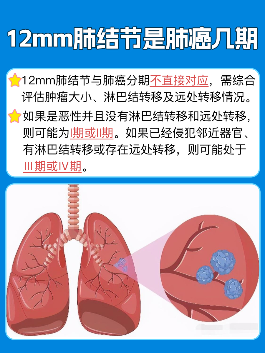 12mm肺结节是肺癌几期，你了解多少