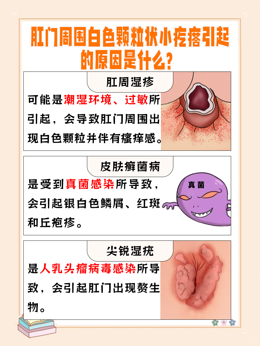 肛门周围白色颗粒状小疙瘩，原因即将揭晓
