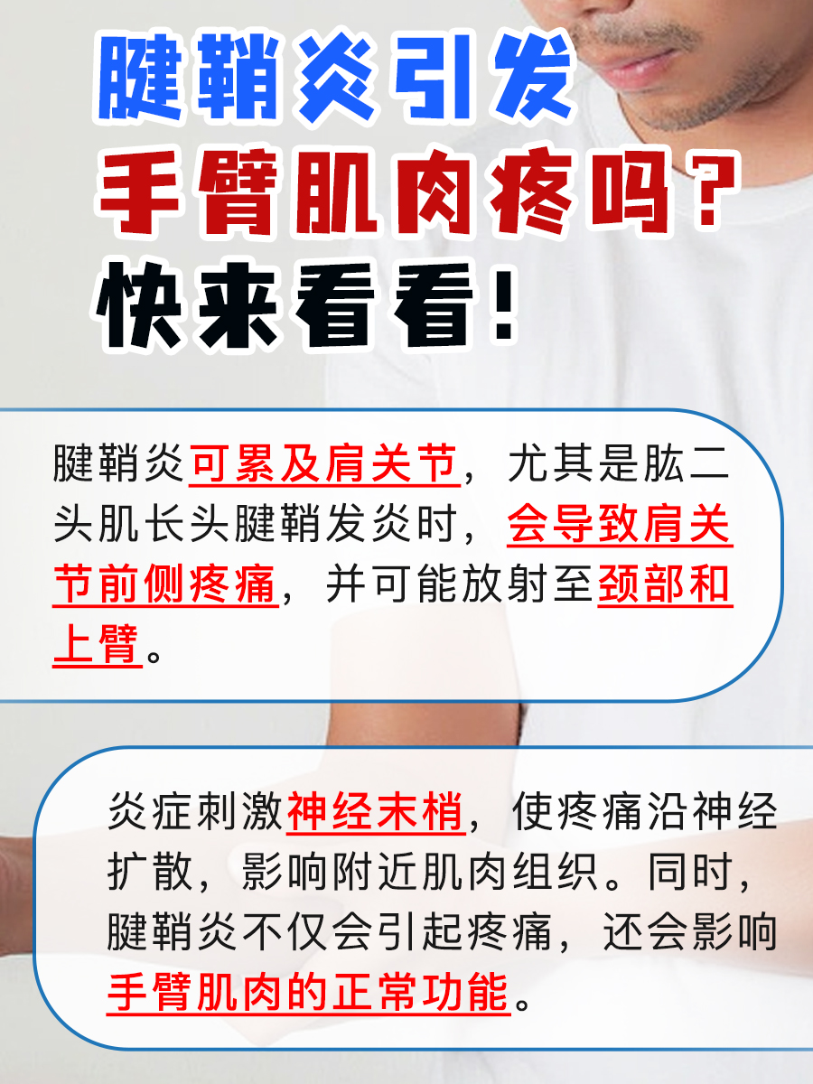 腱鞘炎来袭,手臂肌肉能否幸免?