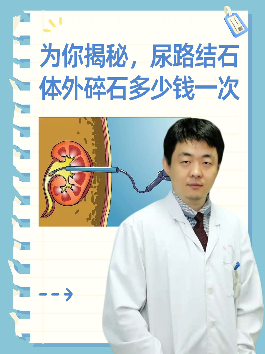 为你揭秘，尿路结石体外碎石多少钱一次