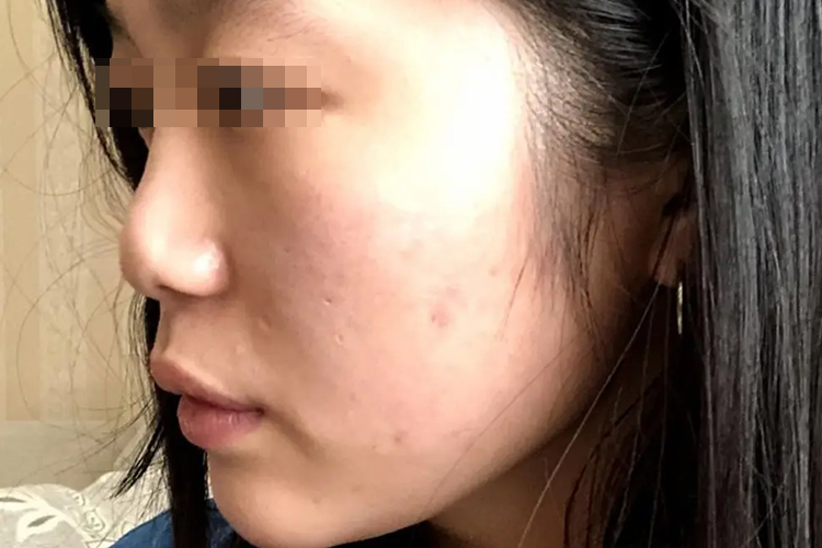 鼻子没有鼻尖图