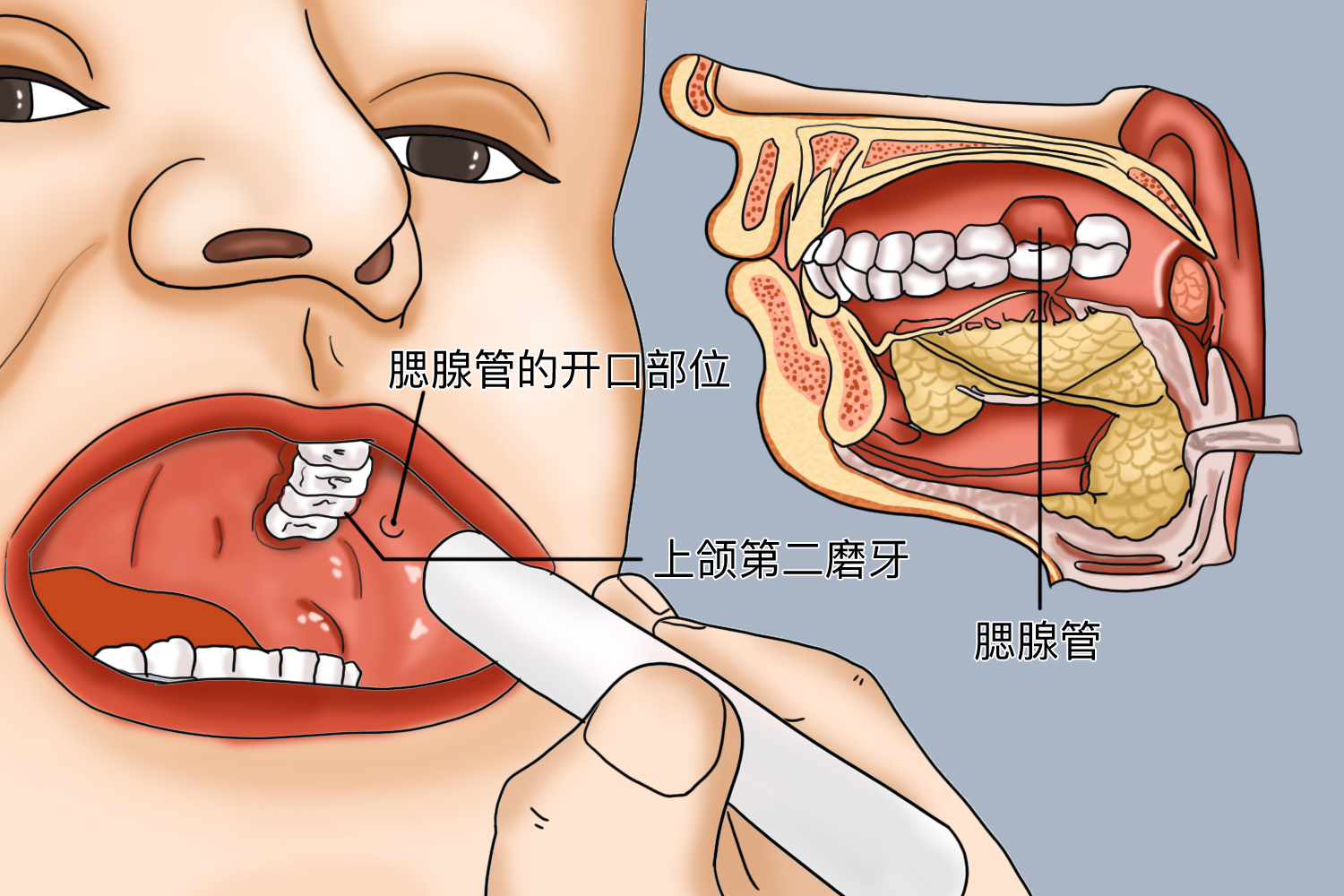 腮腺管口位置图