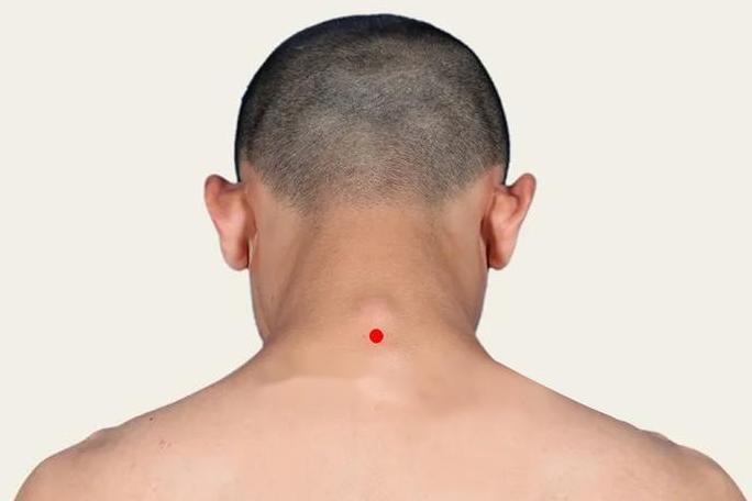 正常颈椎第七节突出图 正常颈椎第七节突出图