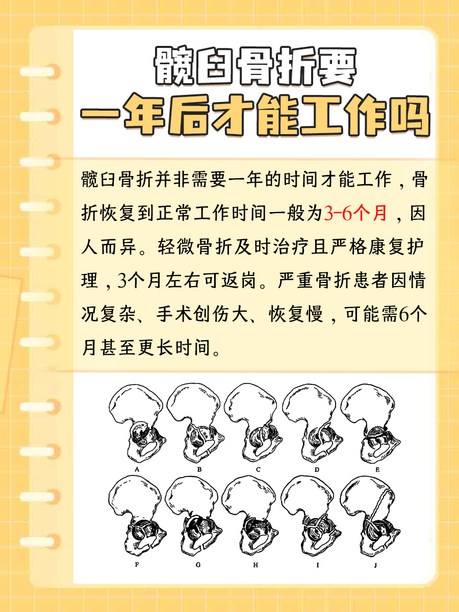 揭秘！髋臼骨折要一年后才能工作吗