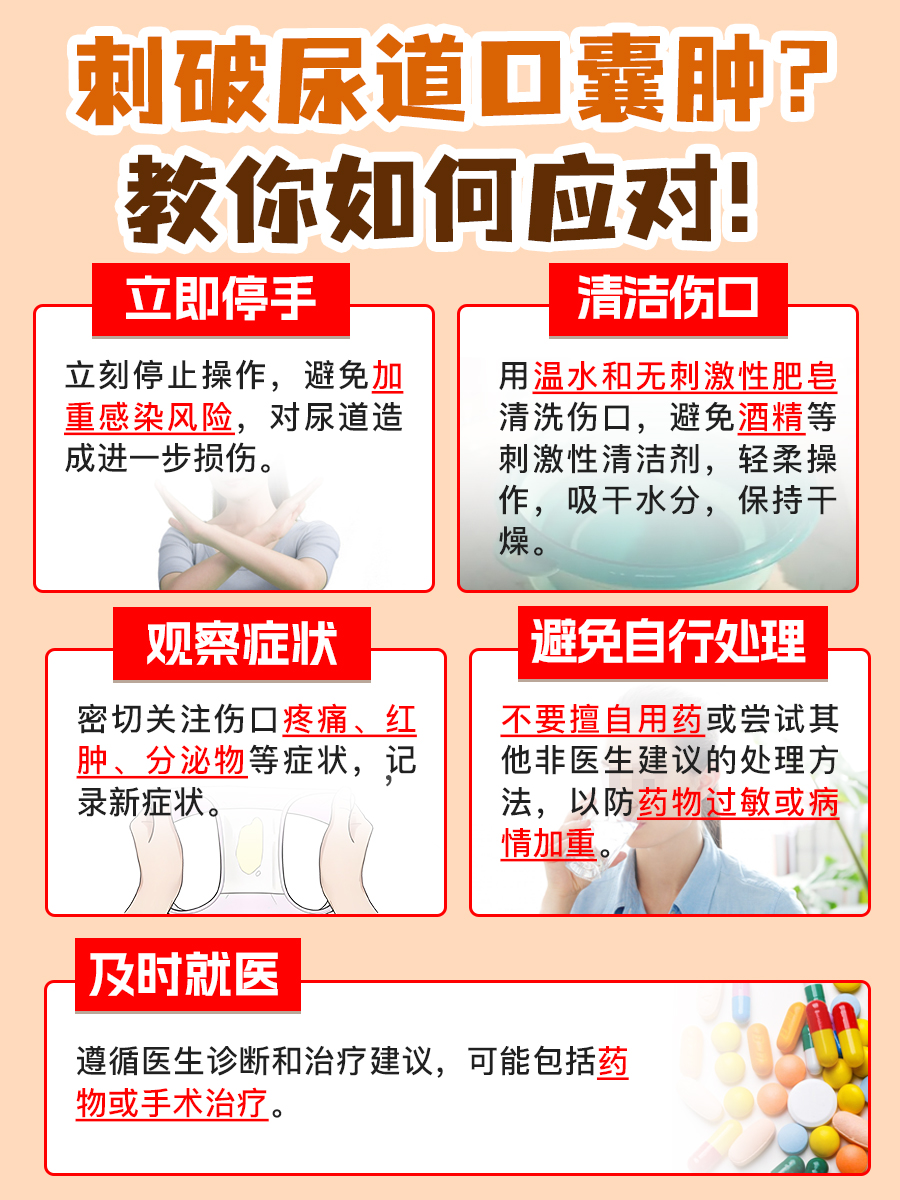 尿道口囊肿不慎刺破？别急，看这里！