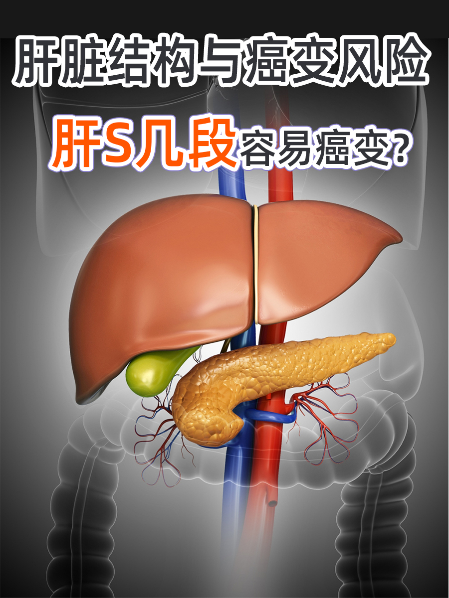 肝脏结构与癌变风险:肝S几段容易癌变?