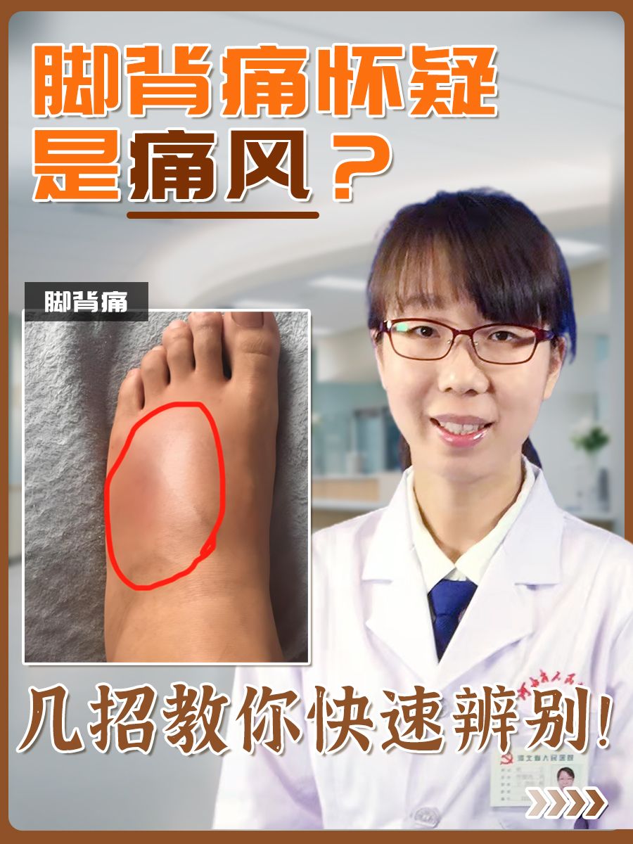 脚背痛怀疑是痛风？几招教你快速辨别！