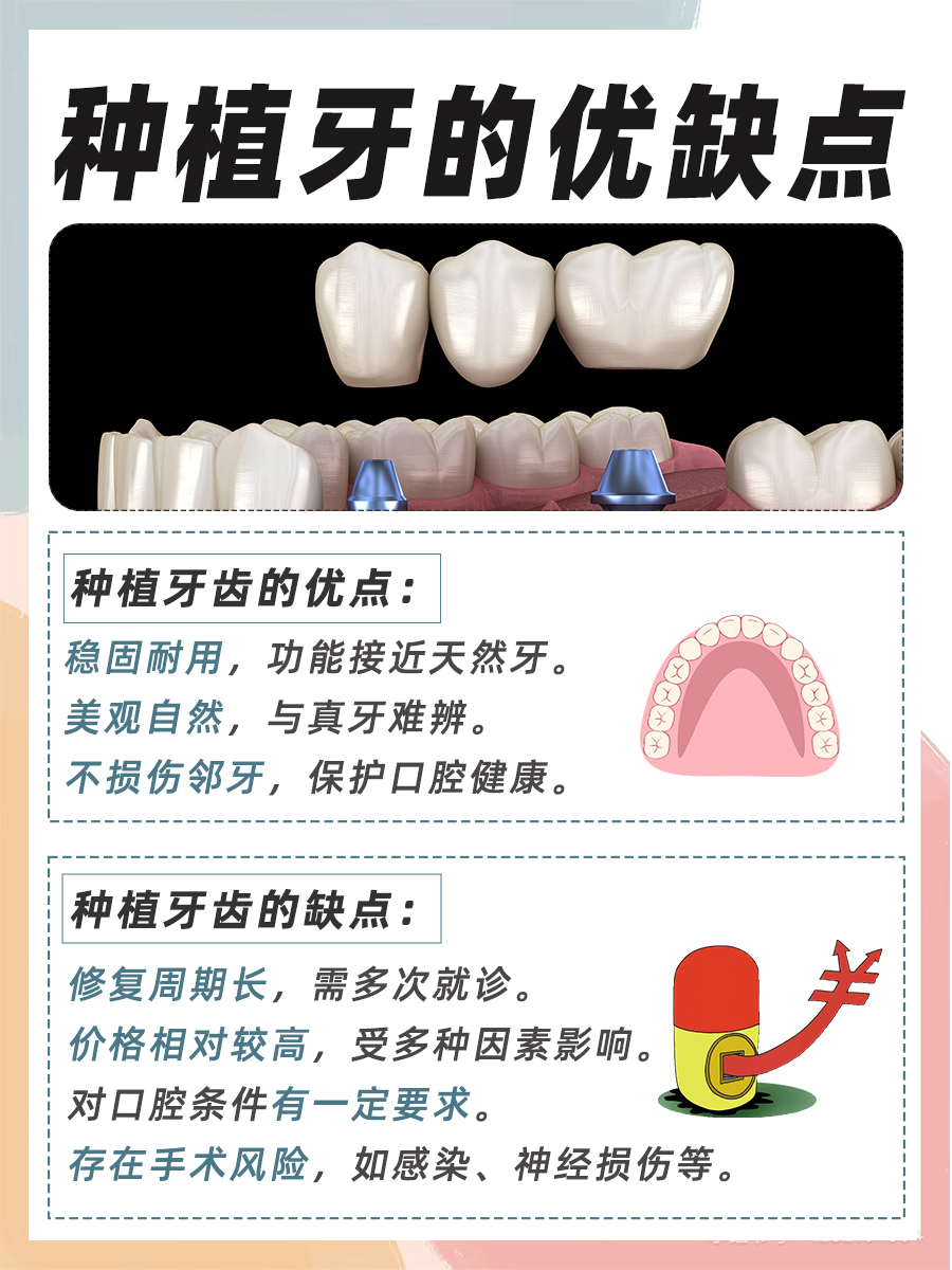 医美解答：种植牙齿多少钱一颗？