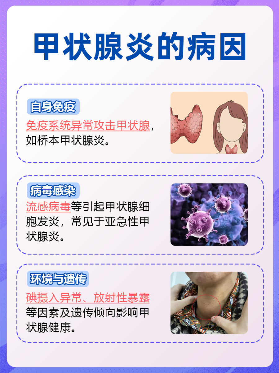 甲状腺炎防护指南：关键注意事项