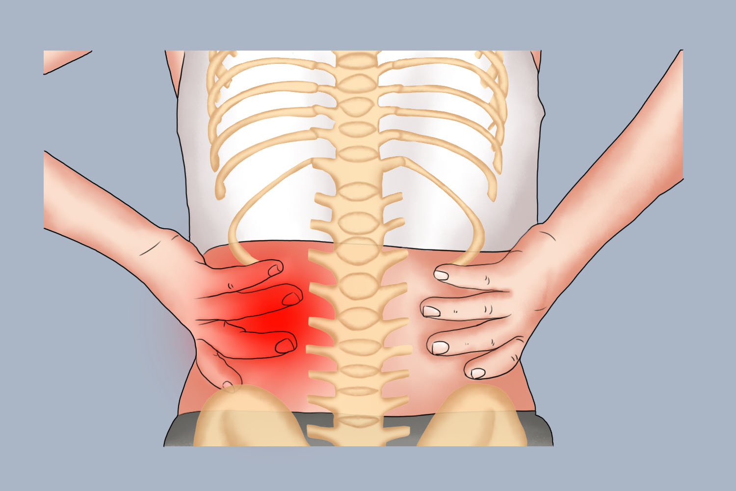 腰肌劳损疼的位置图片图片