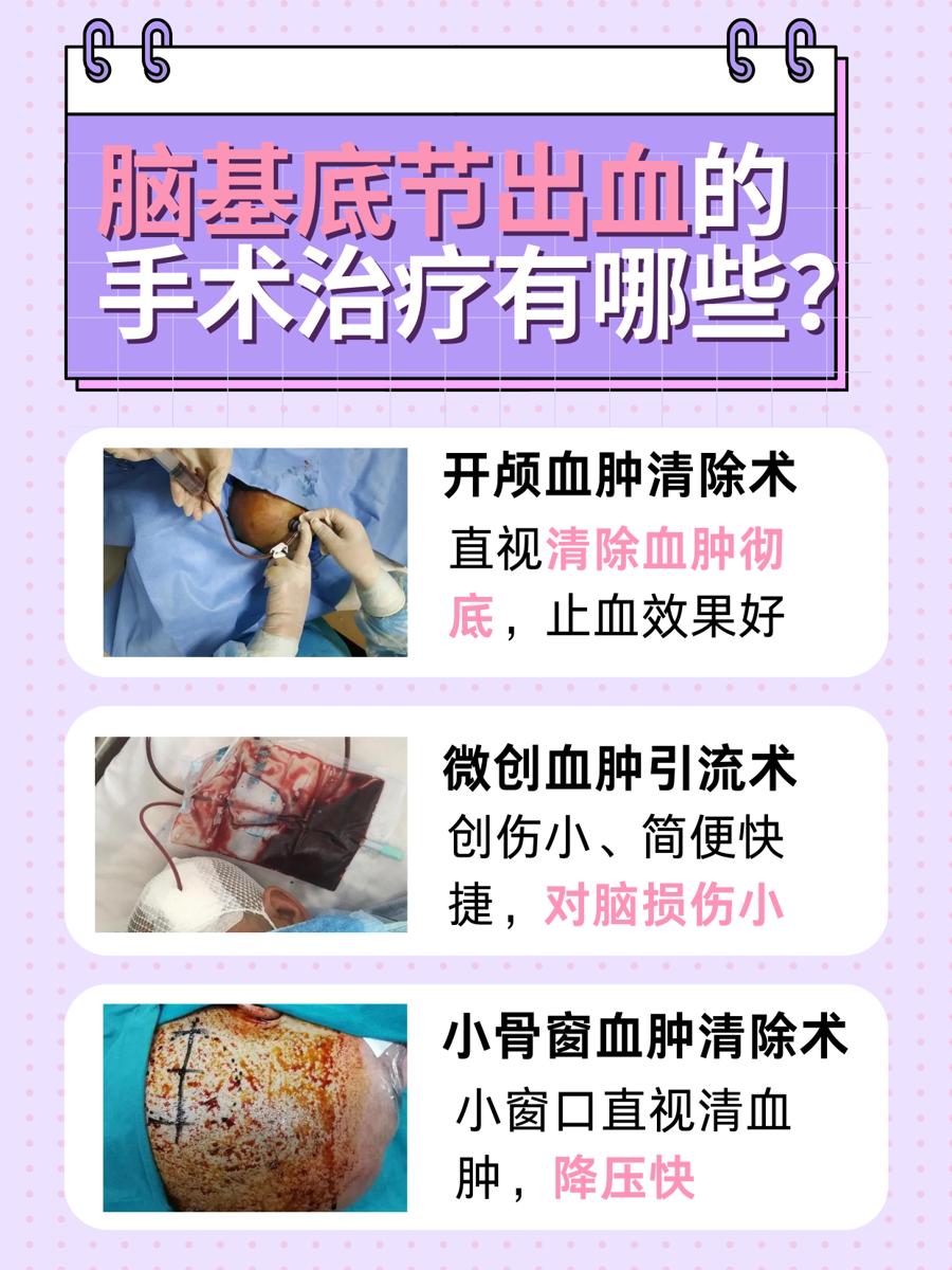 医生揭秘！脑基底节出血能恢复正常人吗