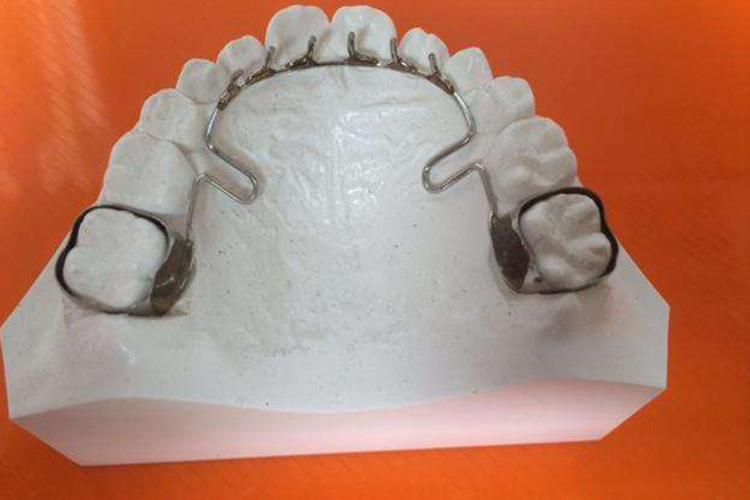 下颌舌弓图 下颌舌弓图