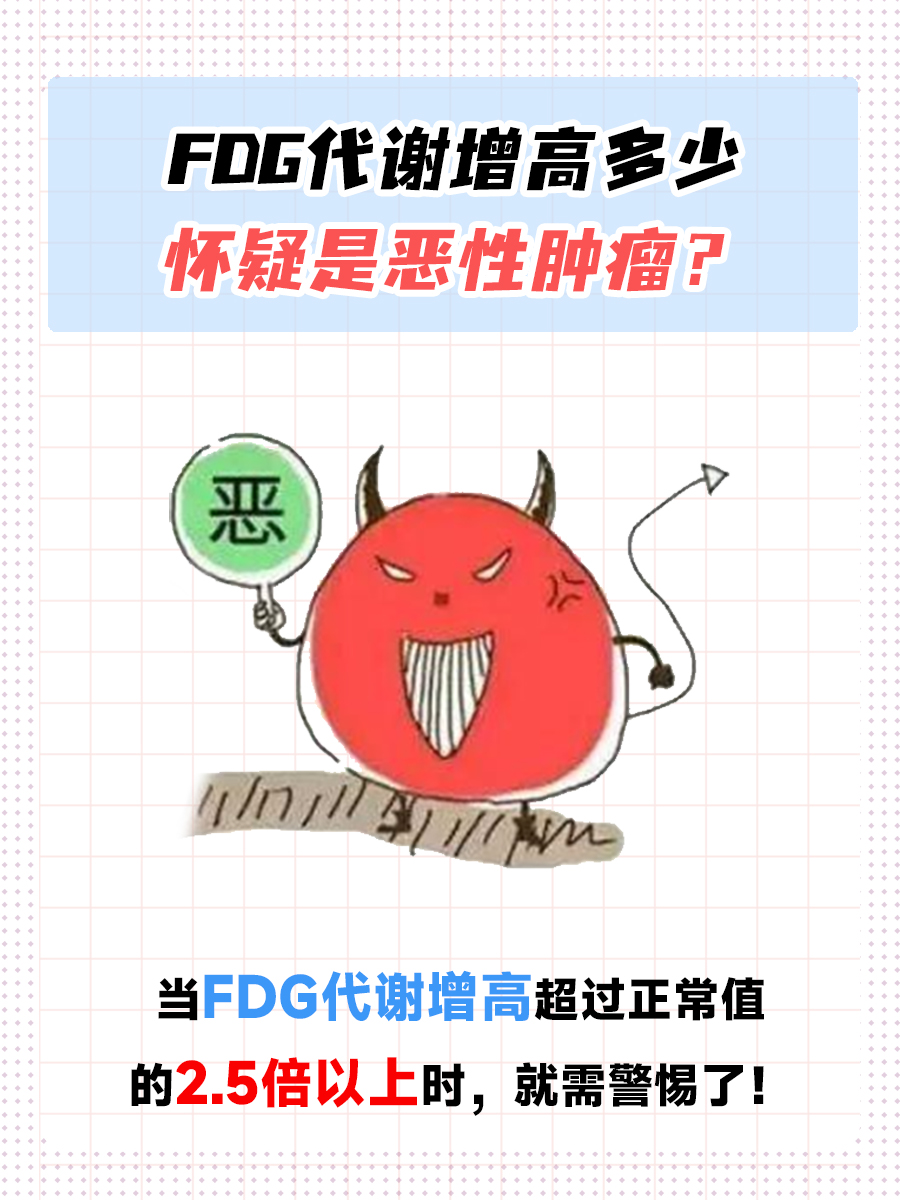 FDG代谢增高多少怀疑是恶性肿瘤？一文告诉你