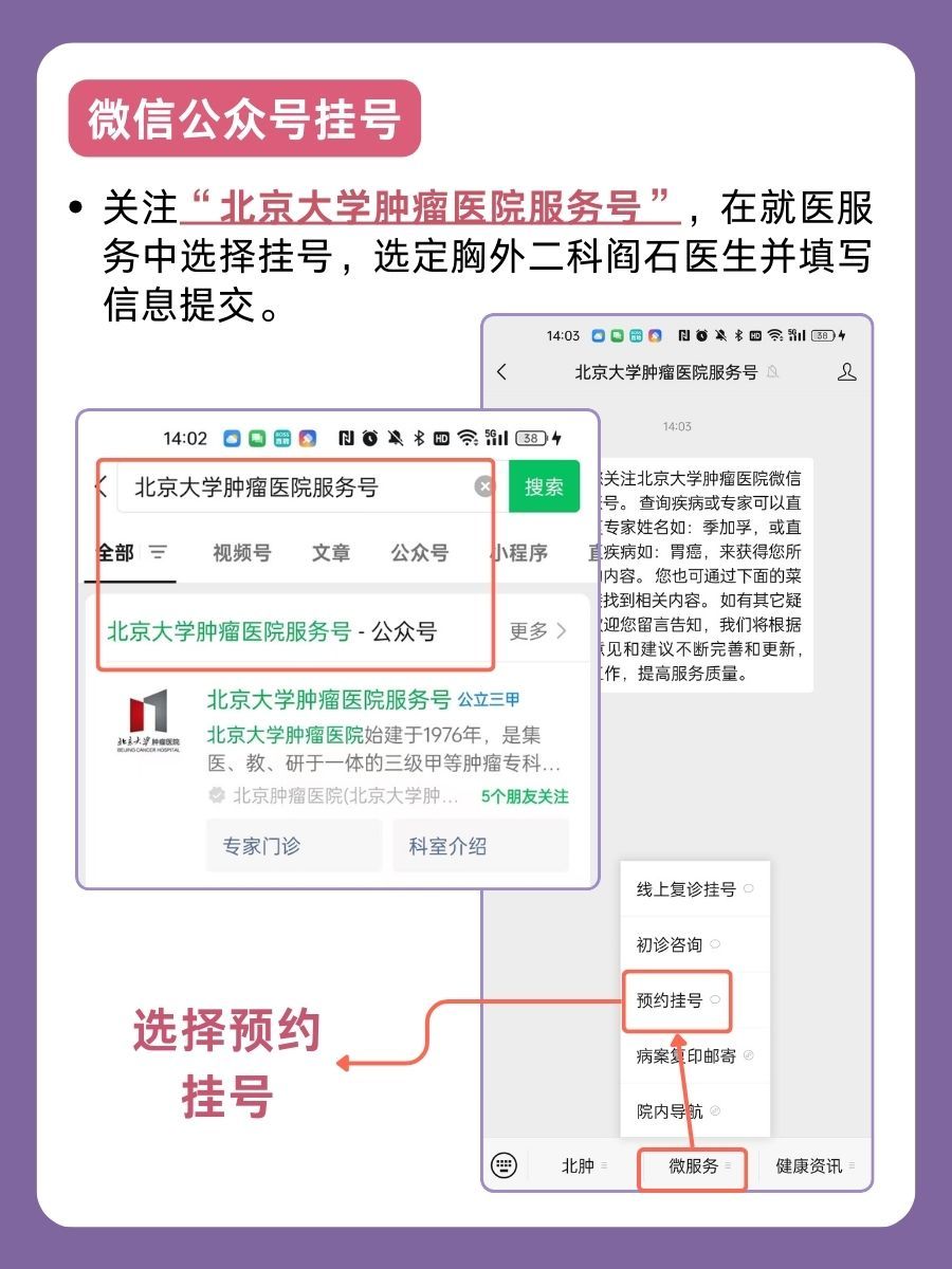 北京大学肿瘤医院阎石医生怎么样？怎么挂号？