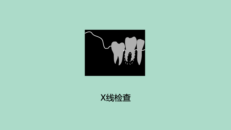 X线检查.png