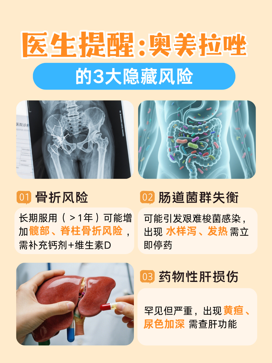 奥美拉唑饭前吃还是饭后吃?正确服用时间大公开!