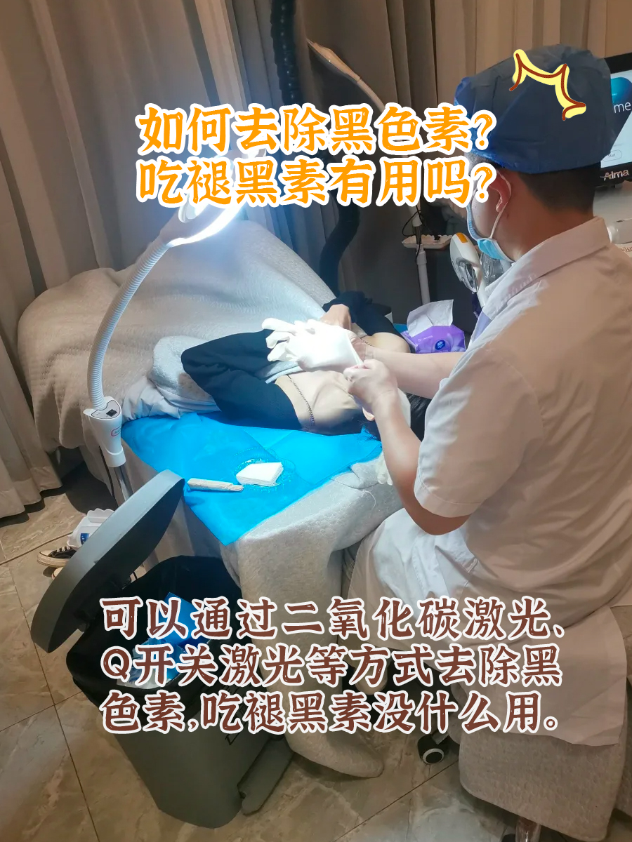 褪黑素能去除黑色素？看完你就懂了！