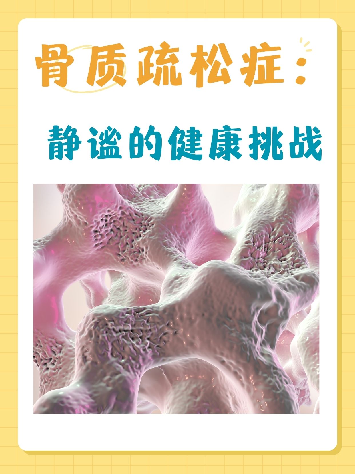 骨质疏松症:静谧的健康挑战