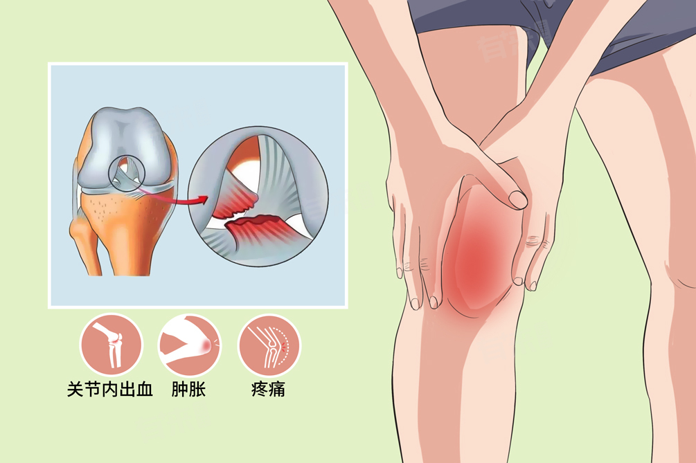 膝关节疼是什么原因