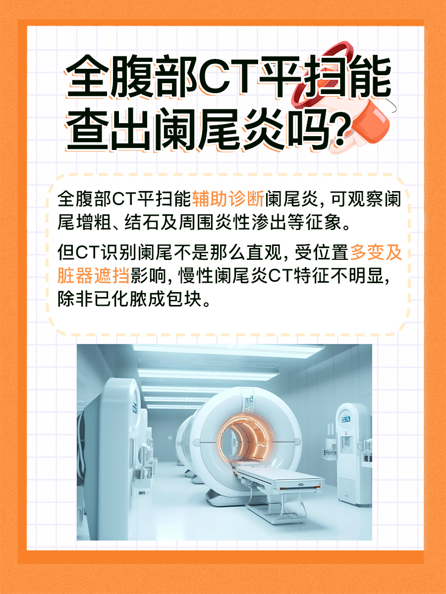 解疑答惑:全腹部CT平扫能查出阑尾炎吗?