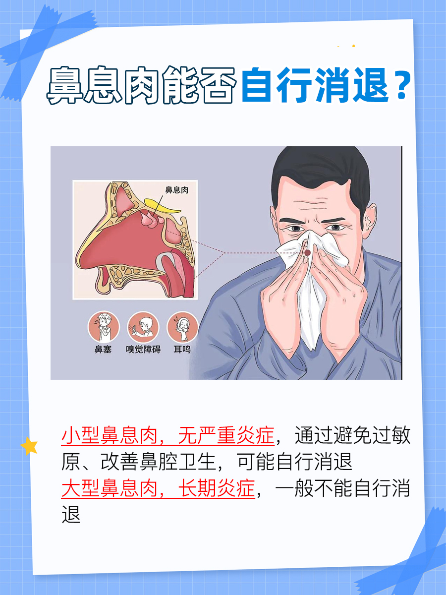 探究：鼻息肉能否自行消退？