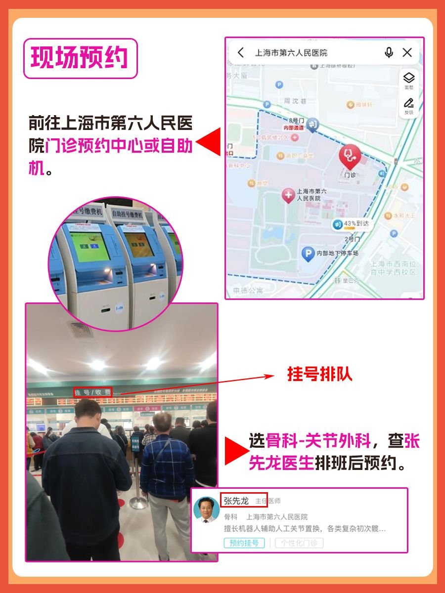 上海市第六人民医院张先龙医生怎么样?怎么挂号?