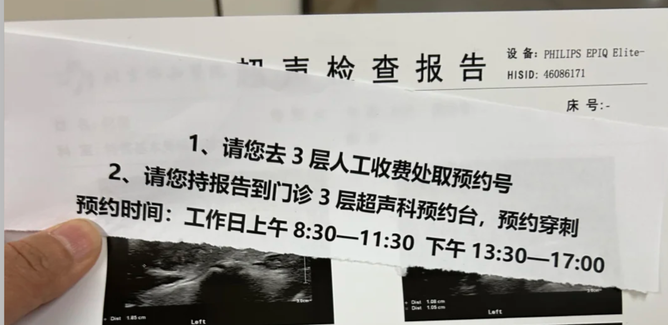 北京协和医院甲状腺穿刺检查需要预约吗?预约流程整理(附图)