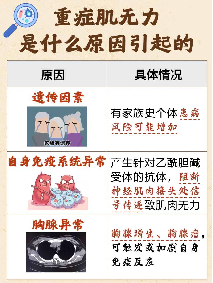 重症肌无力是什么原因引起的？你知道吗