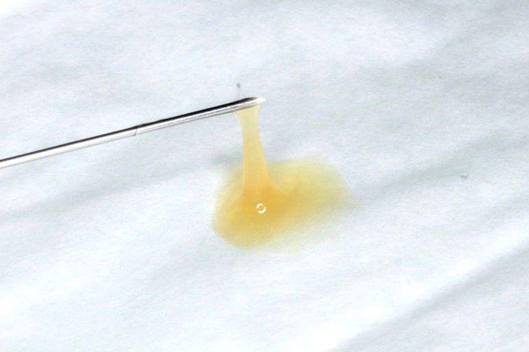 宫颈纳囊刺破取出后图