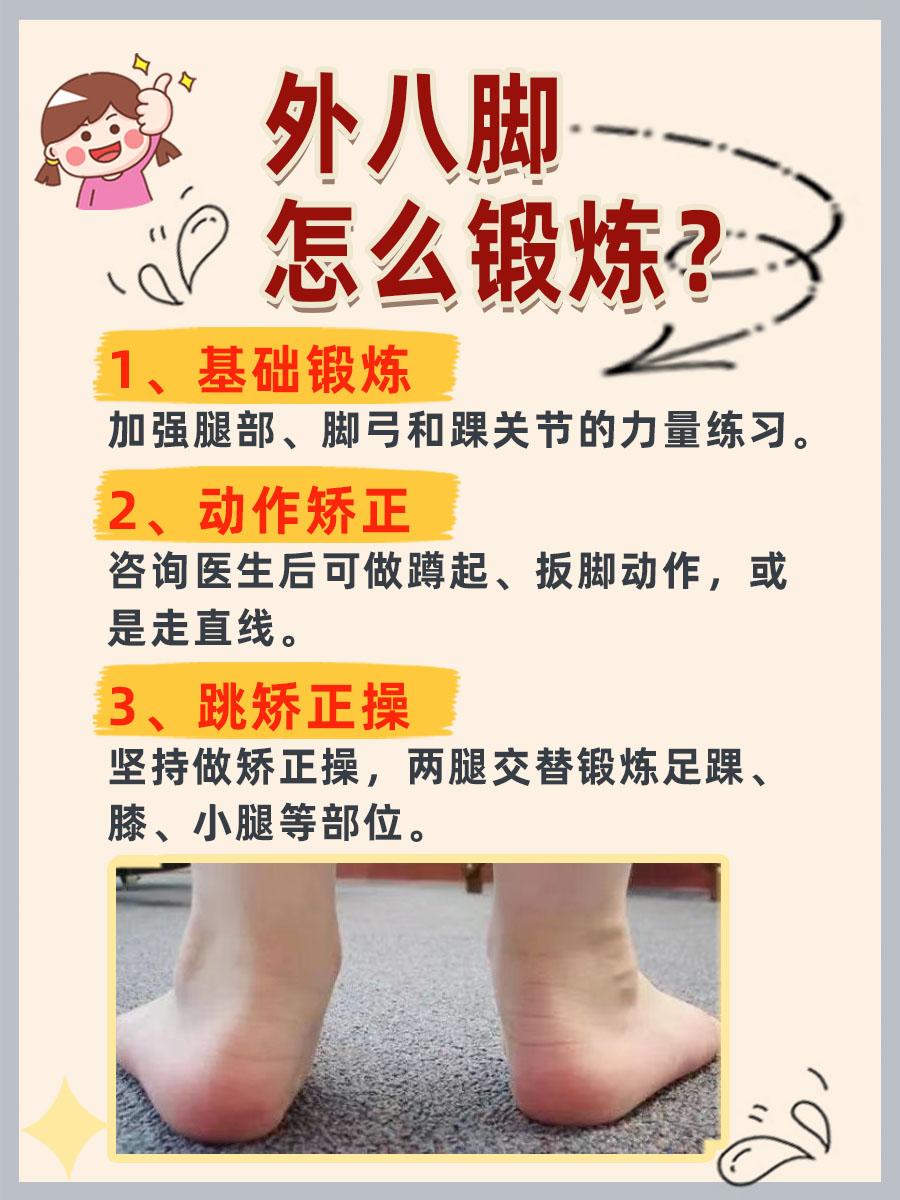 外八脚不再尴尬,轻松矫正走起!