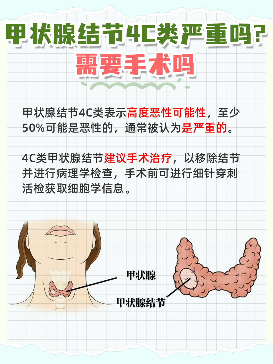 甲状腺结节4C类严重吗？要手术吗？专家解析