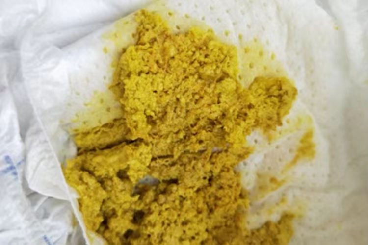 人工喂养正常大便图