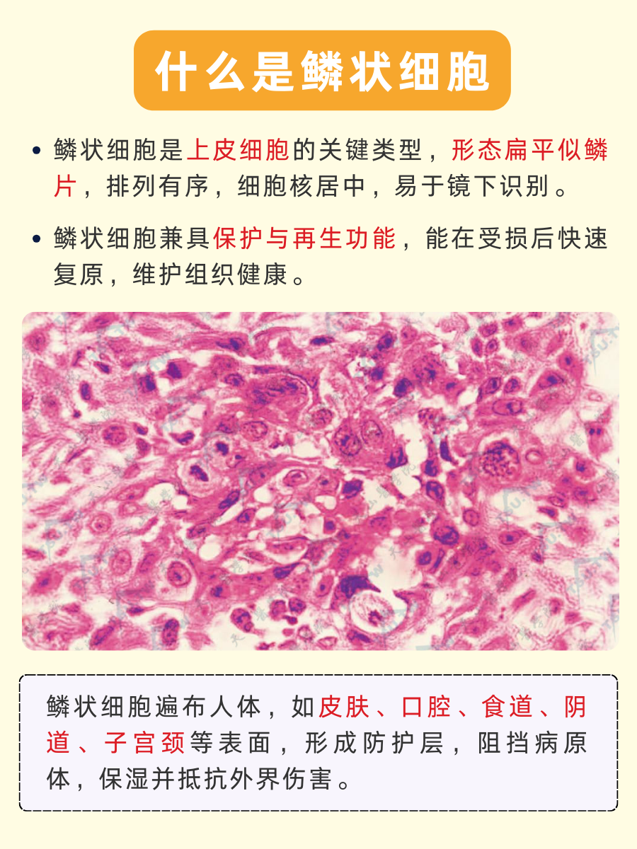 鳞状细胞解析，你关心的都在这里！